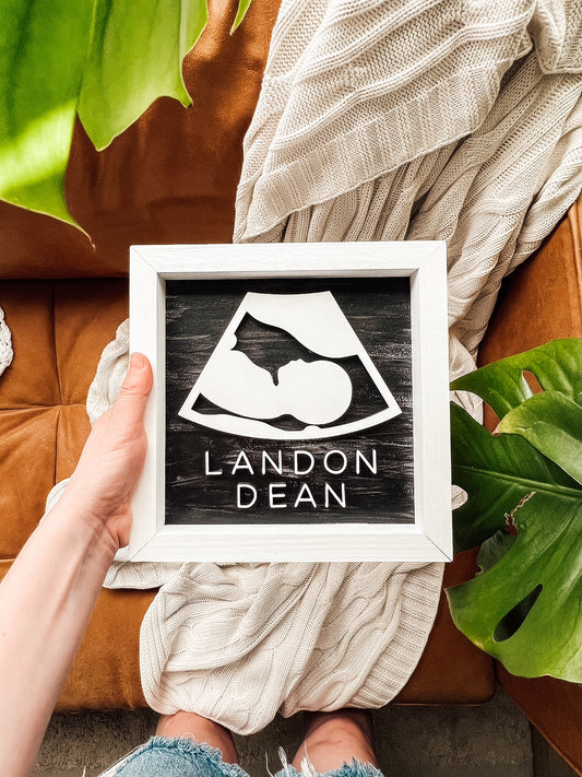 3D Wooden Ultrasound