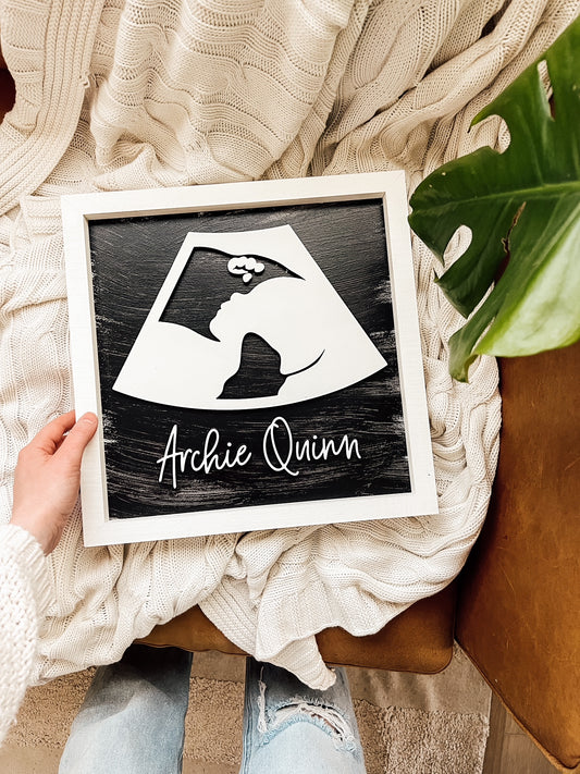 3D Wooden Ultrasound